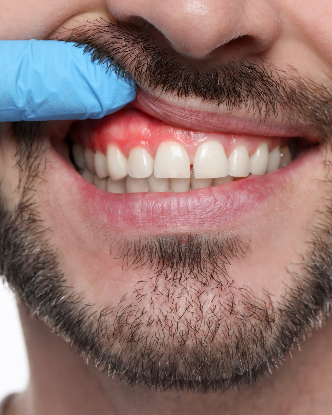 PERIODONTOLOJI